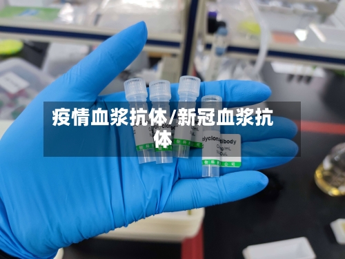 疫情血浆抗体/新冠血浆抗体