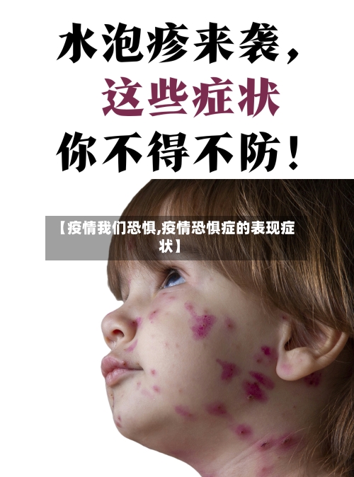 【疫情我们恐惧,疫情恐惧症的表现症状】-第2张图片