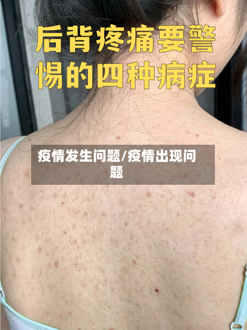 疫情发生问题/疫情出现问题