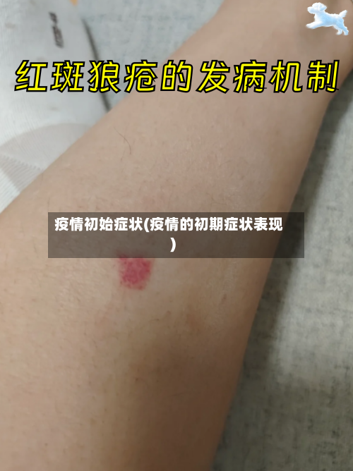 疫情初始症状(疫情的初期症状表现)-第2张图片