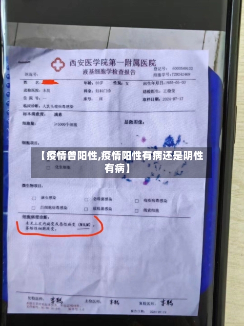 【疫情曾阳性,疫情阳性有病还是阴性有病】-第2张图片