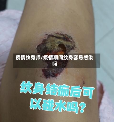 疫情纹身师/疫情期间纹身容易感染吗-第2张图片