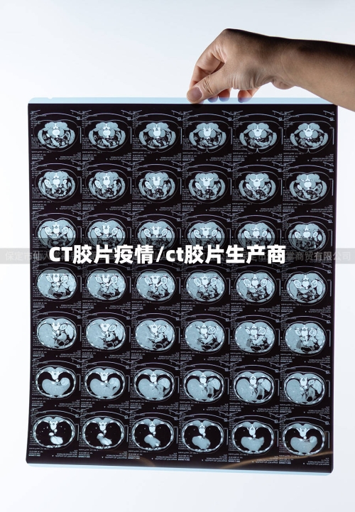 CT胶片疫情/ct胶片生产商-第1张图片