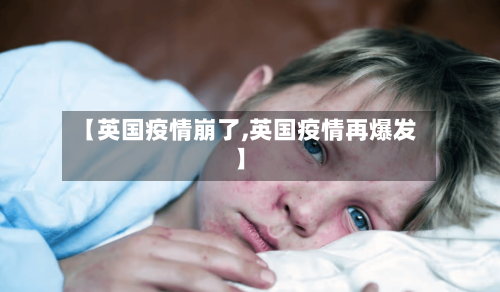 【英国疫情崩了,英国疫情再爆发】-第1张图片