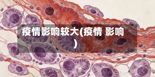 疫情影响较大(疫情 影响)-第3张图片