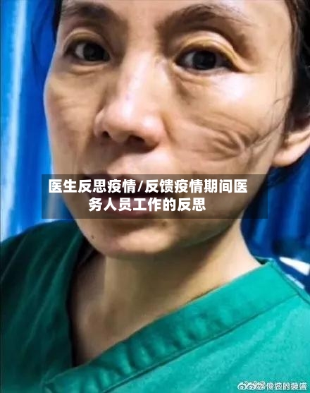医生反思疫情/反馈疫情期间医务人员工作的反思-第1张图片